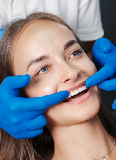 Fillings